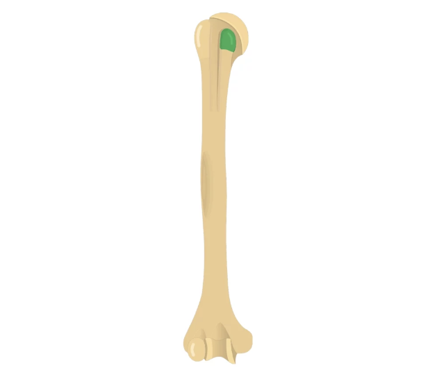 <p>What part of the humerus is this?</p>