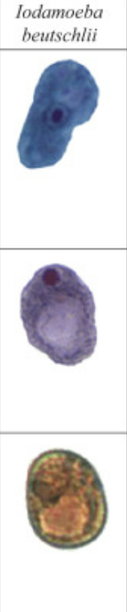 <p>Iodamoeba butschilii</p>