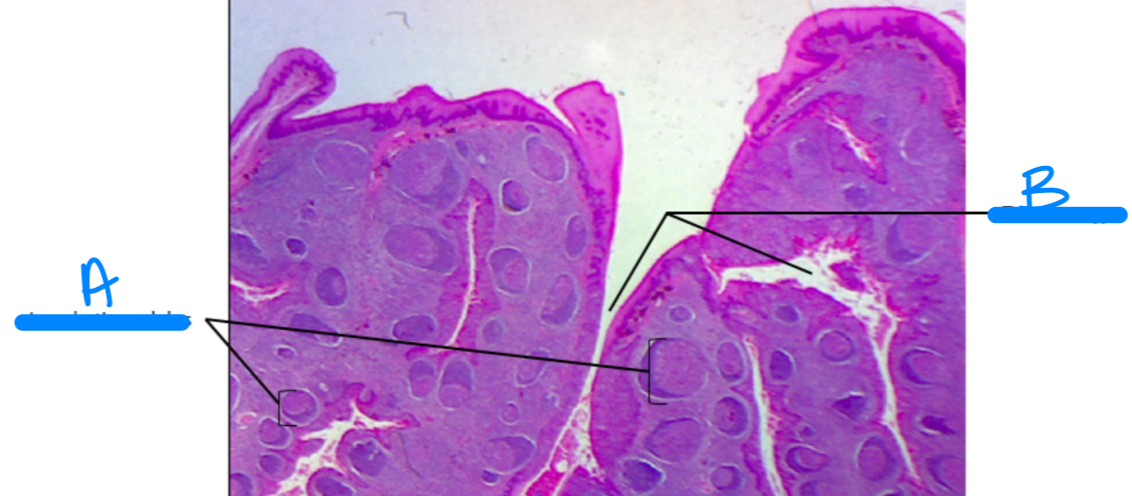 <p>B</p>