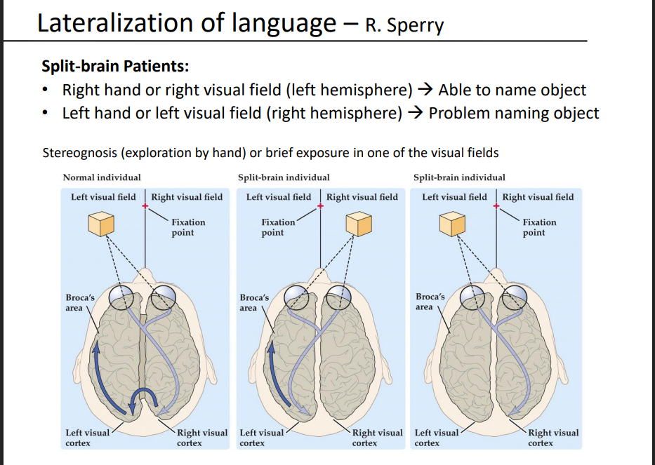 <p>In split-brain patients, when can they name an object correctly?</p>