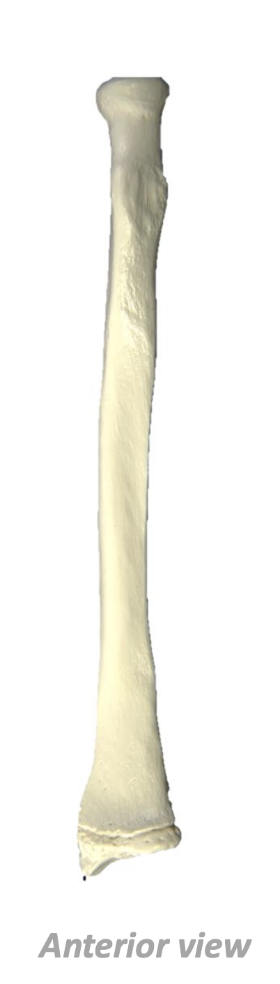 <p>What Bone Is This?</p>