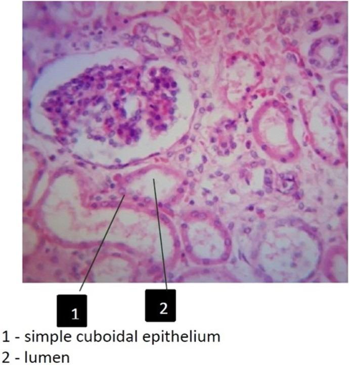 <p>1- simple cuboidal epithelium</p><p>2- lumen</p><p>Location : Renal/kidney tubules, thyroid/pituitary gland</p>