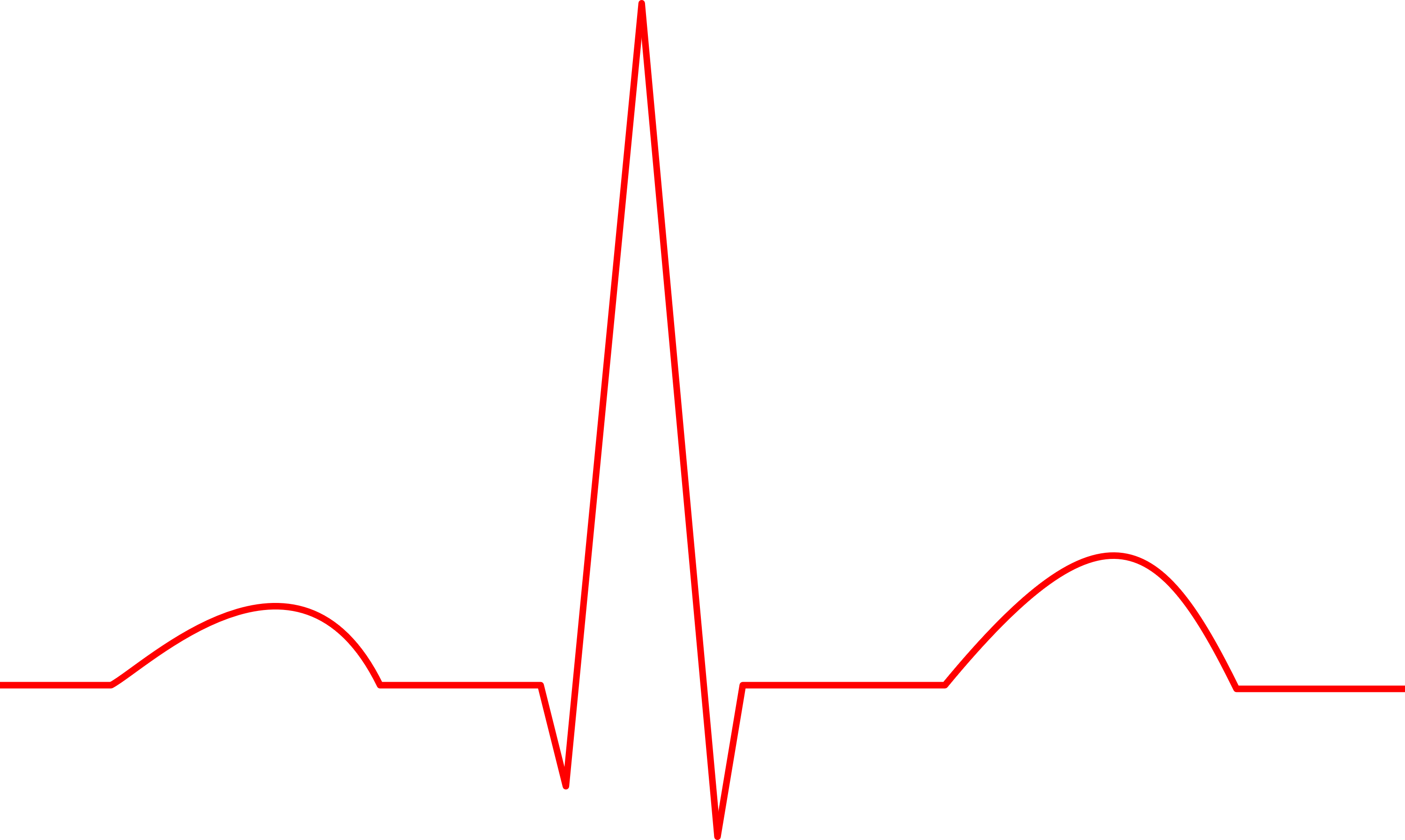 <p>Electrical picture of heart<br>Measured w/ skin electrodes</p>