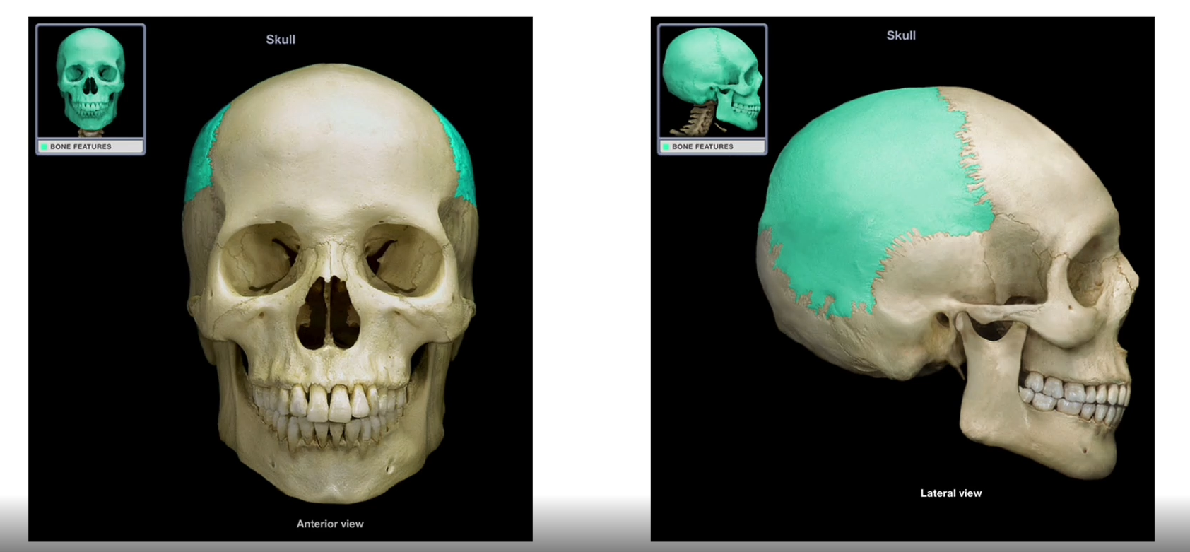 <p>Parietal Bones</p>