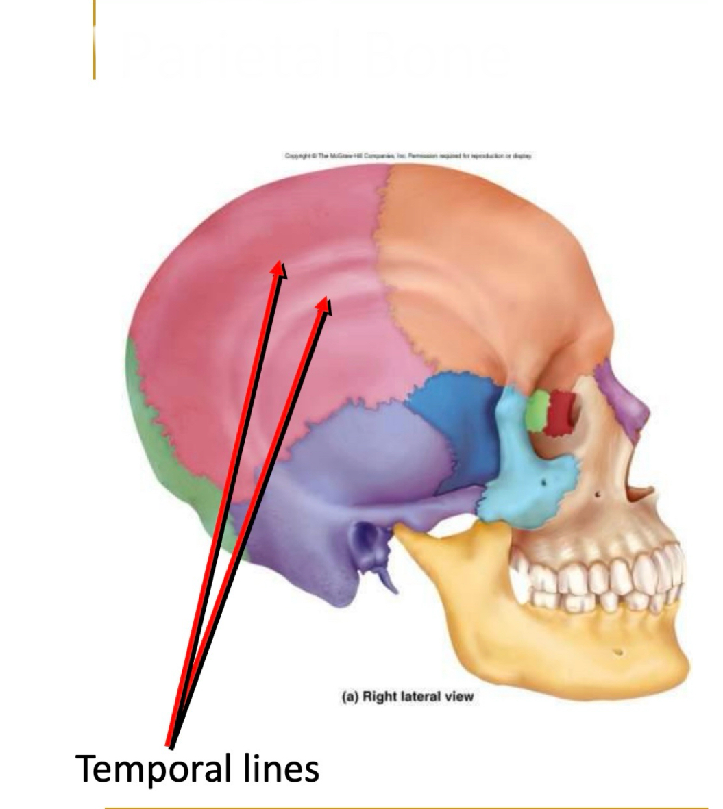 <p>What bone is this?</p>