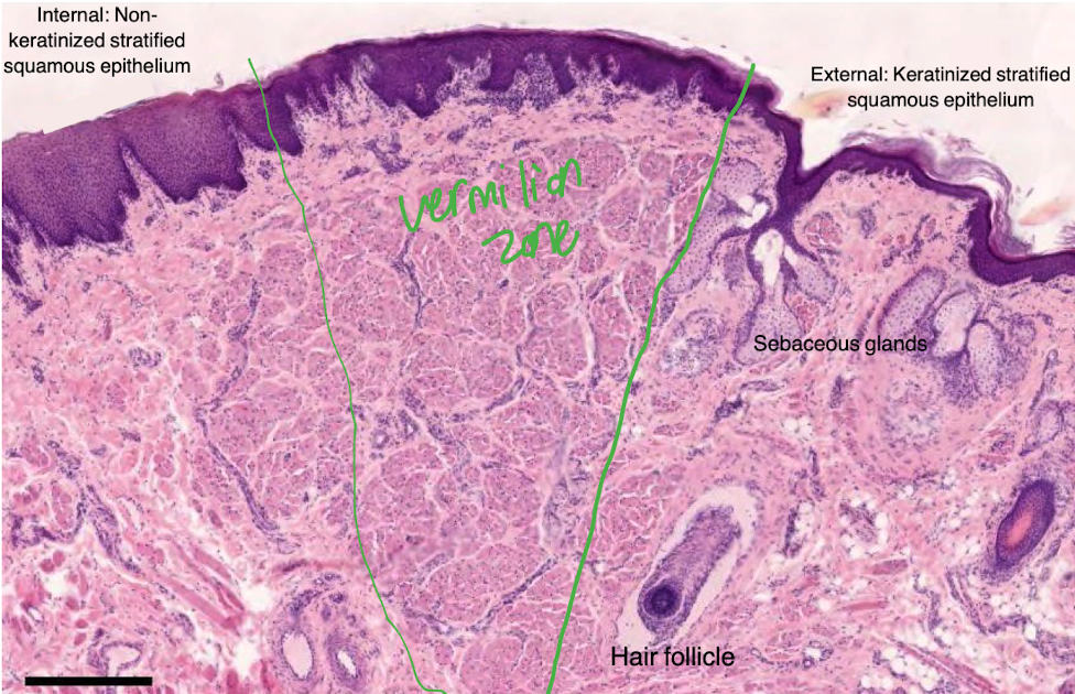<ul><li><p>no sweat or sebaceous glands (need moisturizer)</p></li><li><p>underlying CT is rich in sensory innervation and capillaries (pink colour)</p></li></ul>