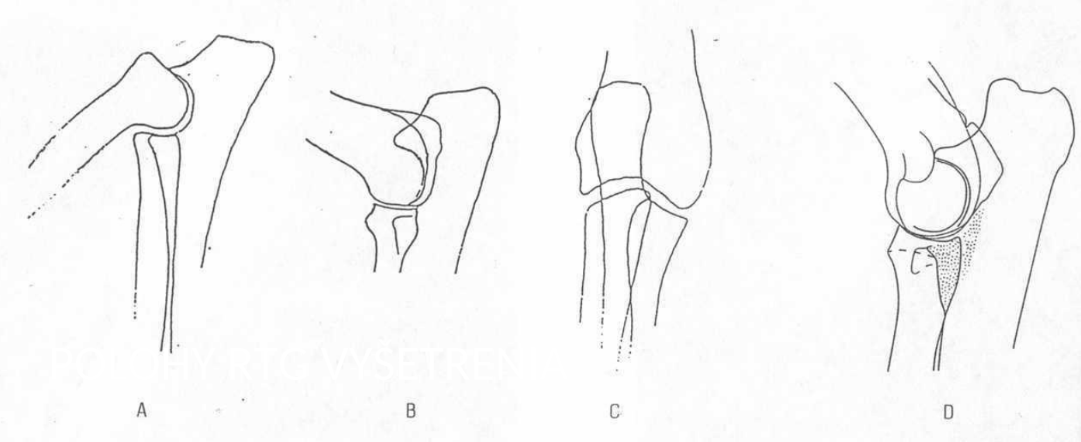 <p>The different joint positions during radiography diagnosis of ED</p>