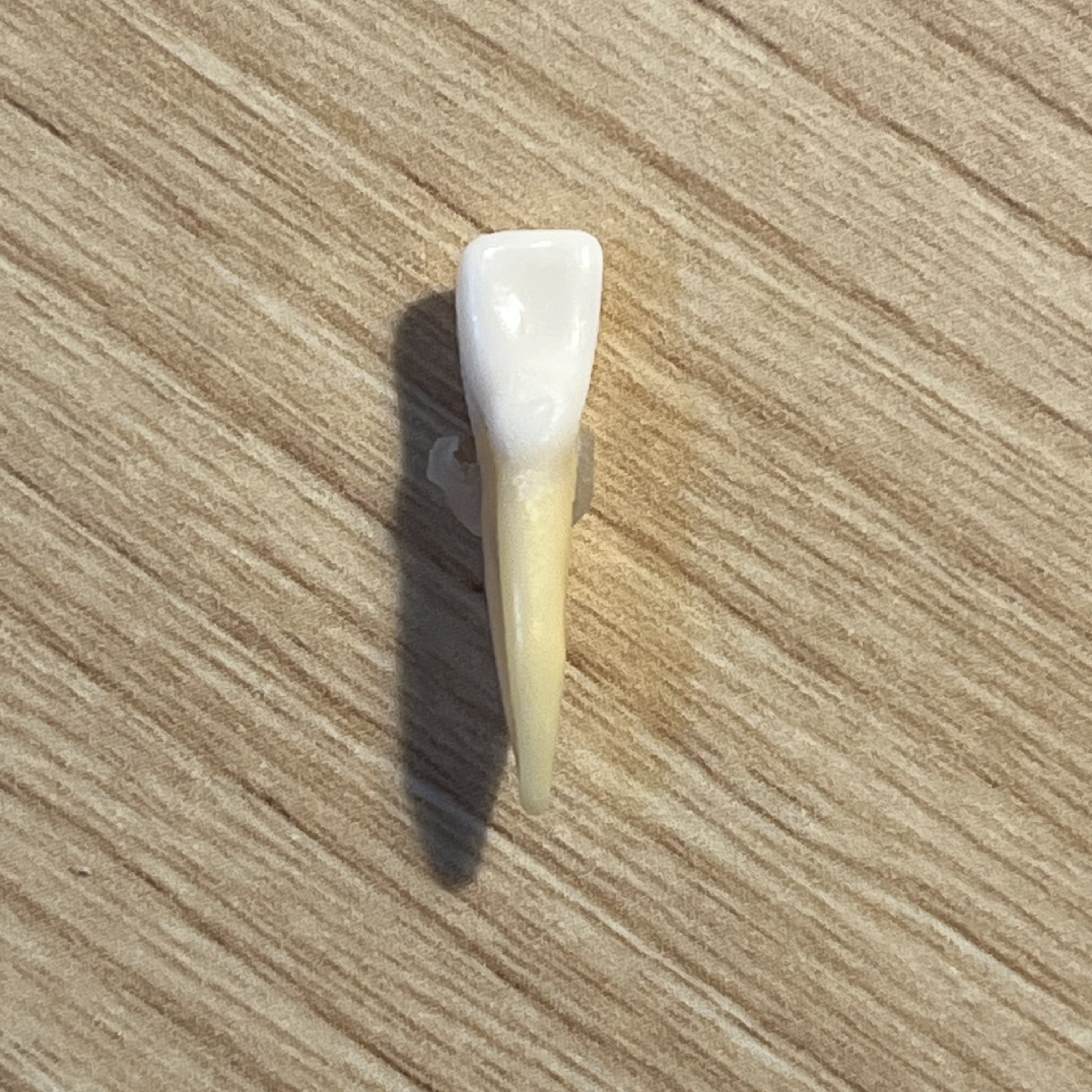 <p>What tooth is this (with view)?</p>