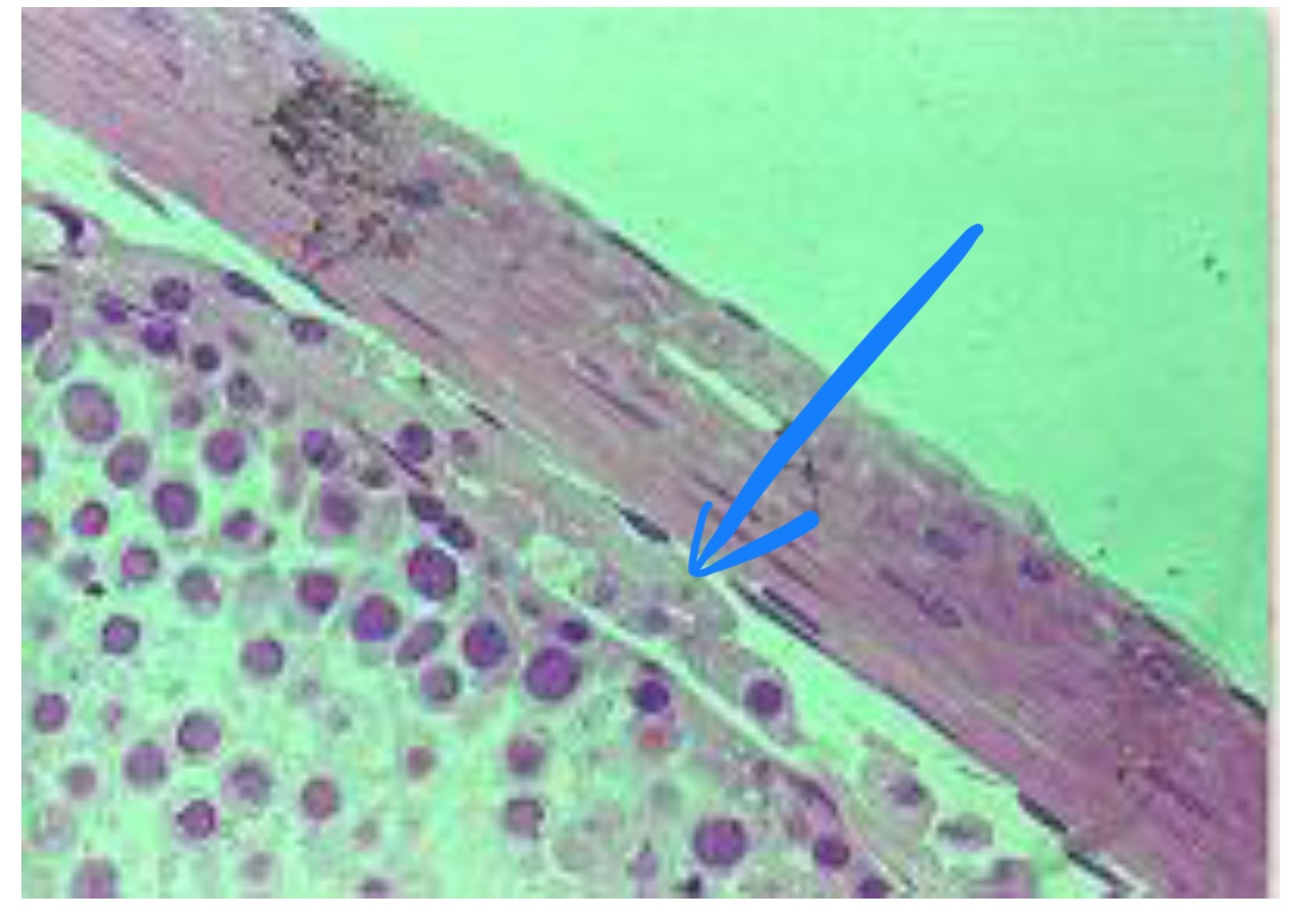 term image