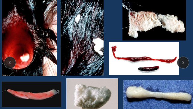 <p><span style="background-color: transparent;"><strong>Urethral Obstruction in Cats</strong></span></p>