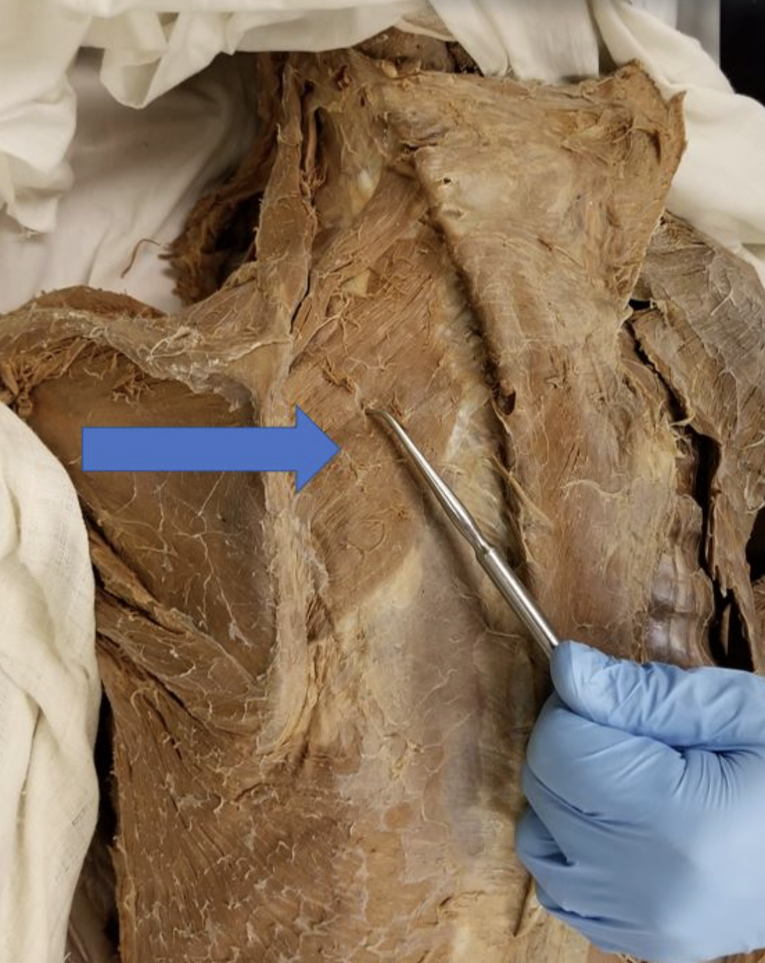 <p>muscle name & action</p>