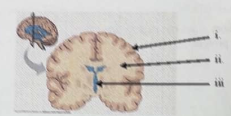 <p>The tissue indicated by i.) is</p><p>a. gray matter</p><p>b. white matter</p><p>c. yellow body</p><p>d. ventricles</p><p>e. meninges</p>