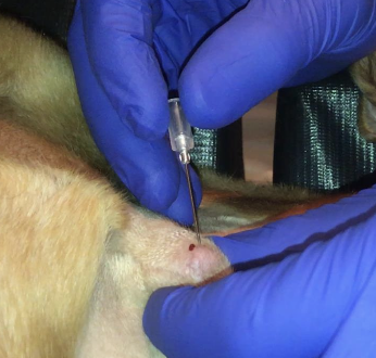 <p>FNA is recommended for cytologic diagnosis, can exclude diagnosis of readily exfoliating tumors</p>