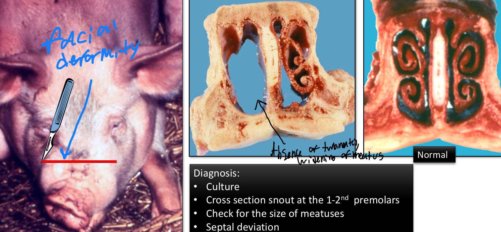 <ul><li><p>Pasturella multocida and Bordetella bronchiseptica</p></li><li><p>Pigs</p></li><li><p>Lesions</p><ul><li><p><strong><u>Atrophic conchae (destruction of conchae)</u></strong></p></li><li><p><strong><u>Facial deformities</u></strong></p></li><li><p>No exudate</p></li></ul></li></ul><p></p>