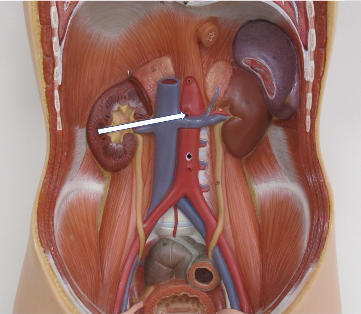 <p><span>Van welk bloedvat zien we hier de opening in de aorta?</span></p>
