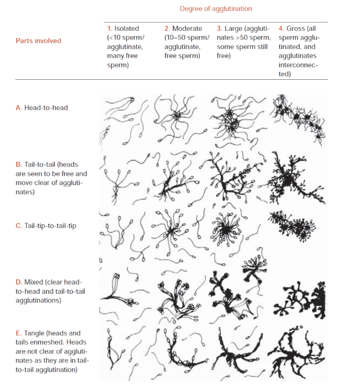 <p>looks at agglutination, debris and round cells </p><p>severe agglutinination suggests prescence of anti sperm antibidoes </p><p>10 micro litre sample </p>