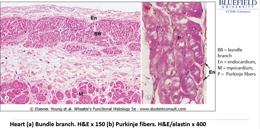 <ul><li><p><strong>Larger</strong> than cardiac myocytes, often <strong>binucleated</strong>.</p></li><li><p><strong>Fewer myofibrils</strong> than typical myocytes.</p></li><li><p><strong>Large glycogen stores</strong> around the nucleus, creating a <strong>clear area (halo)</strong> in histological sections.</p></li></ul><p></p>