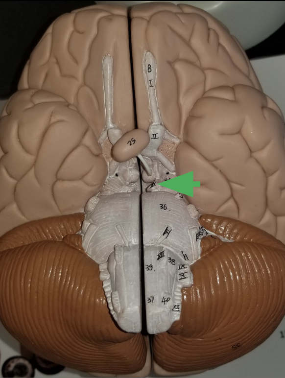 <p>What is the arrow pointing at? </p>