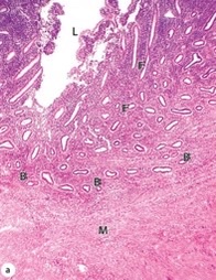 which uterine stage?