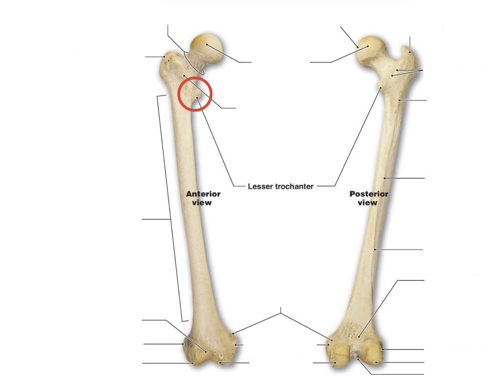<p><span><span>Lesser Trochanter</span></span></p>