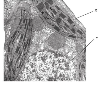 <p>The electron micrograph shows a section through a cell. What is the name of the cell component labelled X?</p>