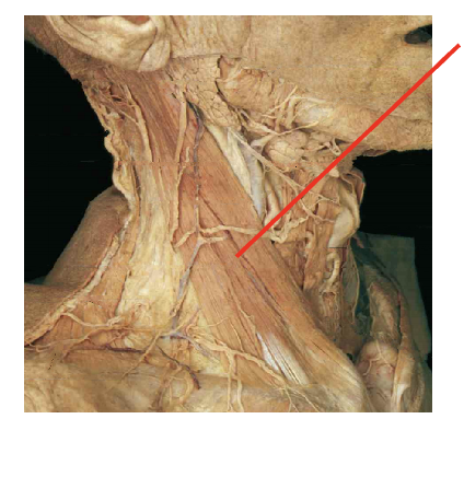 <p>What is this muslcle&nbsp;What is its origin. Where does it inserts. </p>
