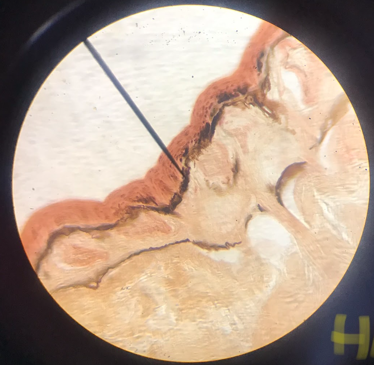 <p>found on the epidermis of the skin; thin outer layer (darkly stained) epidermis; thick inner layer (lightly stained) dermis;  </p>