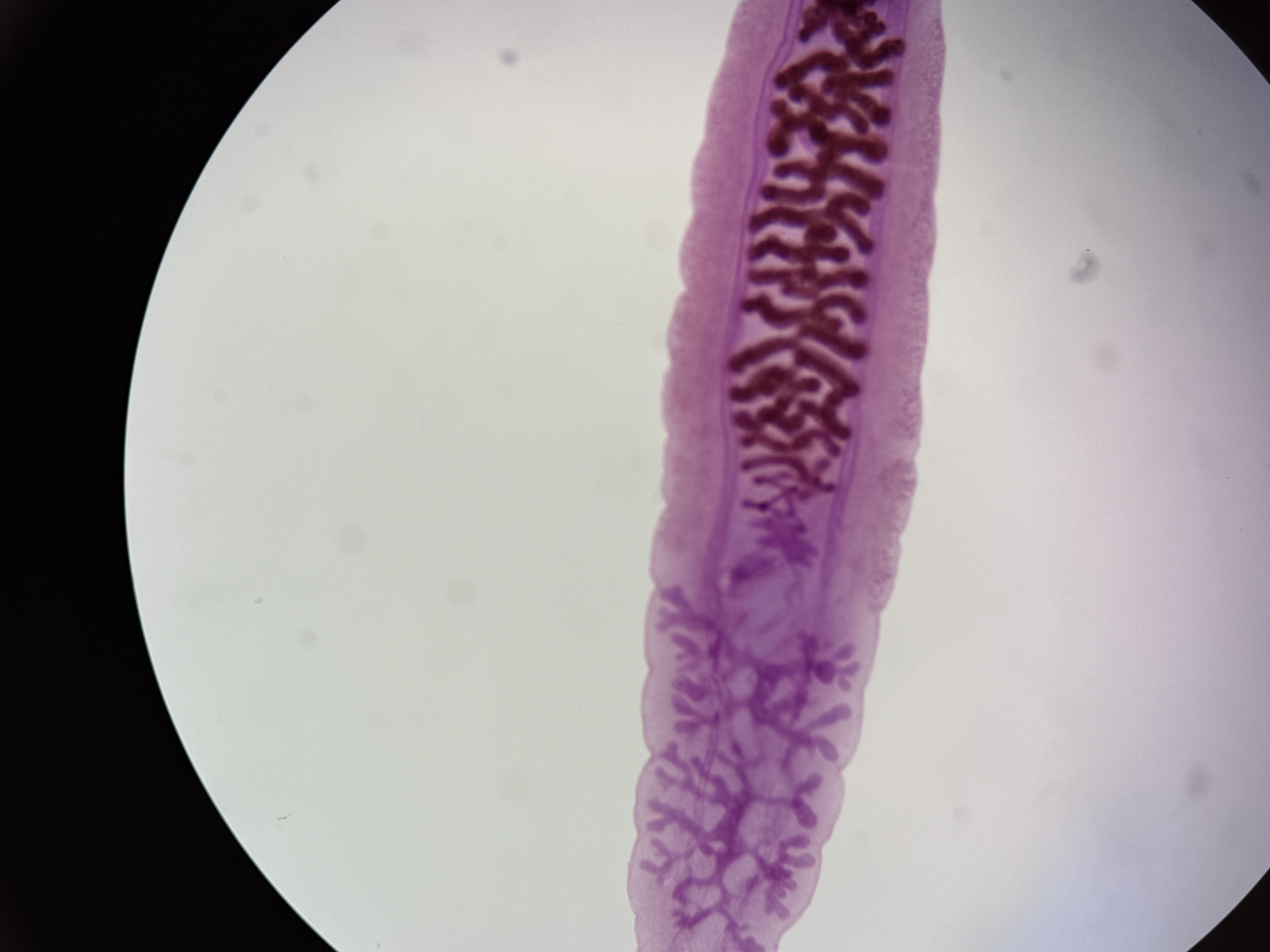<p>What’s the left and right of Clonorchis sinesis?</p>