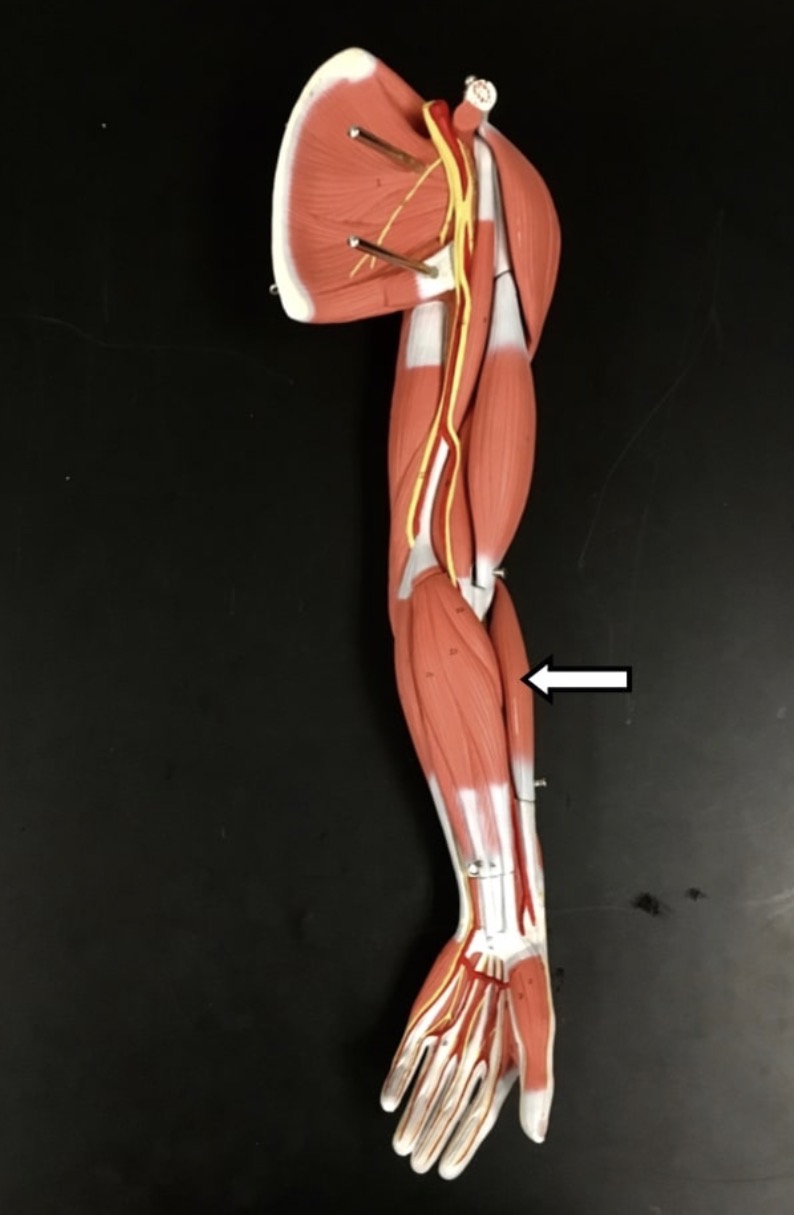 <p><span>Name the muscle labeled with the white arrow below AND name ONE action</span></p>