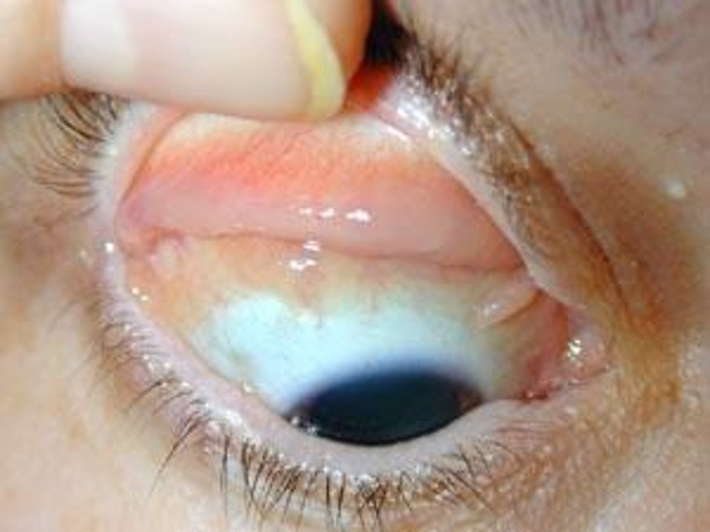 <p>covers inside of eyelids and keeps it lubricated</p>