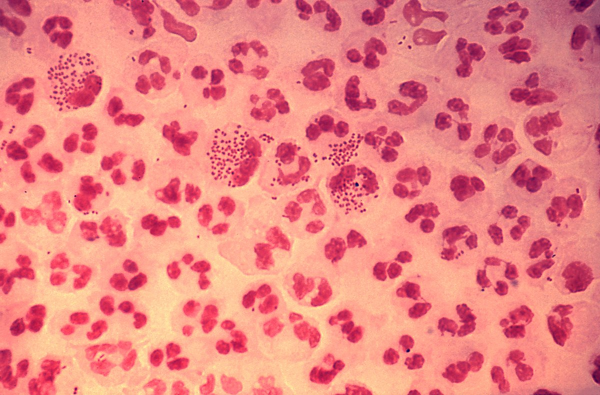 <p>A STD, a diploid (2×2) shaped bacteria</p>