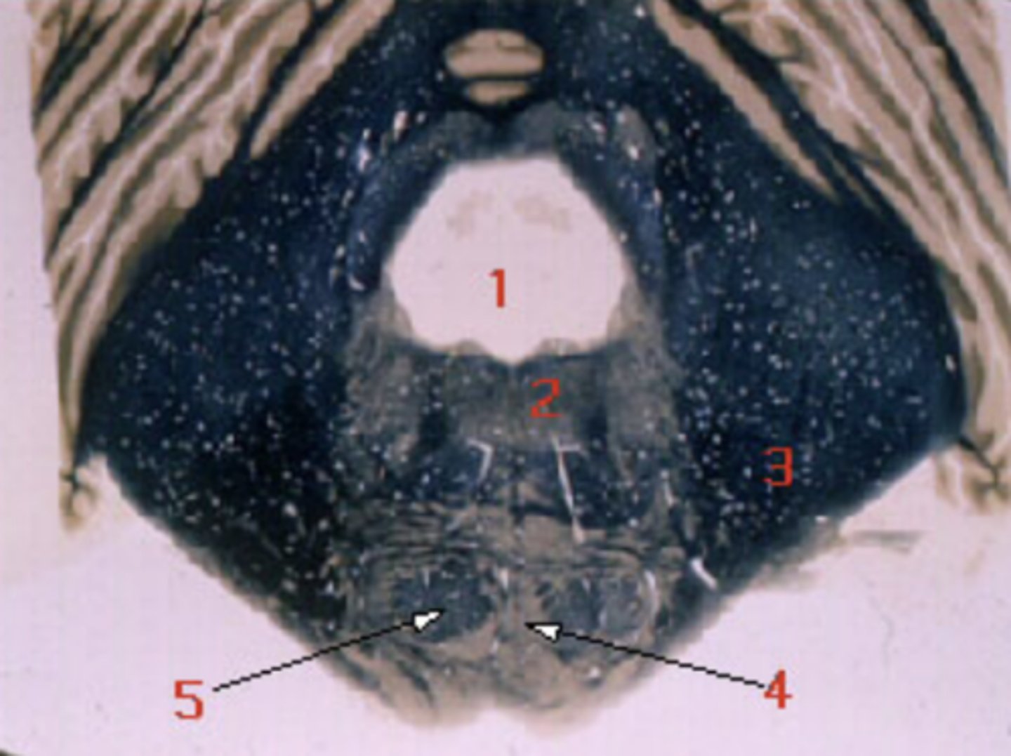 <p>corticopontine, corticospinal, corticobulbar fibers</p>