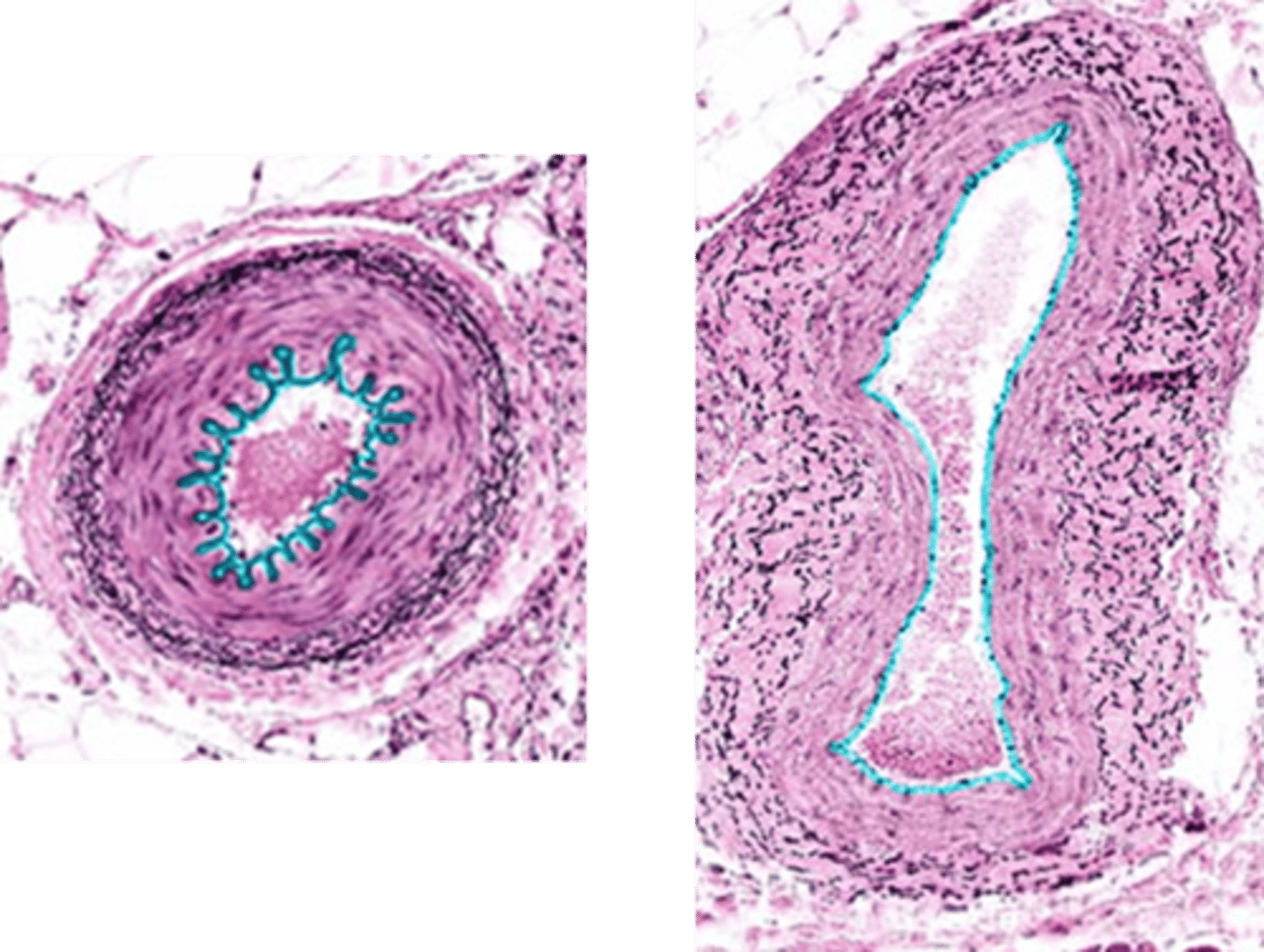 <p>Identify this vessel layer.</p>