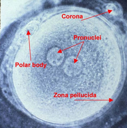 <ul><li><p><strong>Stored Nutrients</strong></p><ul><li><p>required for at least the early stages of embryonic development</p></li><li><p>mammal eggs contain few nutrients</p></li><li><p>eggs of birds and reptiles contain all nutrients required for complete embryonic development</p></li></ul></li><li><p><strong>Egg Coats</strong></p><ul><li><p>protect the egg from injury and infection and, in some species, protect the embryo after fertilization </p></li></ul></li><li><p><strong>Mechanisms</strong> that prevent the egg from being fertilized by more than one sperm cell </p></li></ul><p></p><p></p>