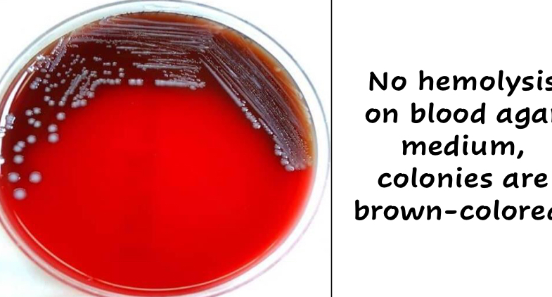 <p>They produce dark brown colonies due to the absorption of hemin</p>