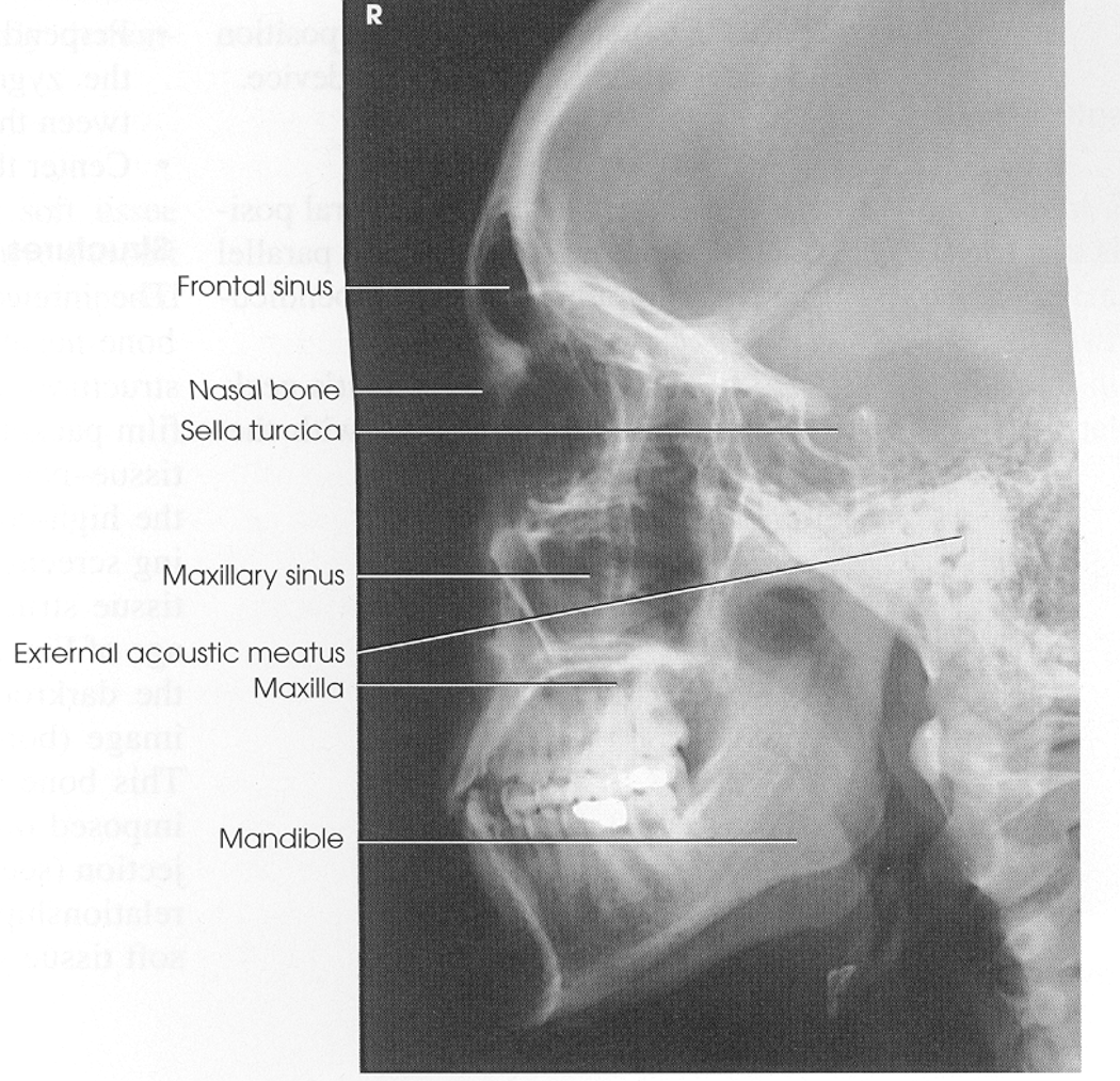 <p>xray</p>