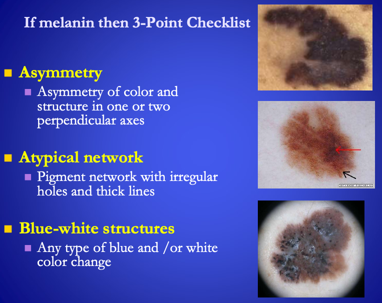 <p><span>If melanin, what are the 3-point checklist?</span></p><ul><li><p><span><strong>[...]</strong></span>&nbsp;</p></li><li><p><span><strong>[...]</strong></span>&nbsp;</p></li><li><p><span><strong>[...]</strong></span>&nbsp;</p></li></ul><p></p>