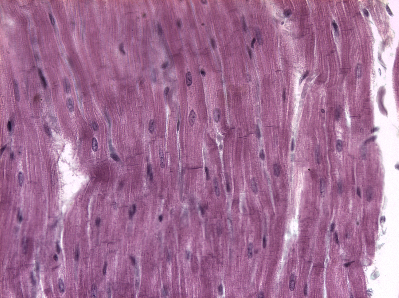 <p>How to identify a cardiac muscle tissue?</p>
