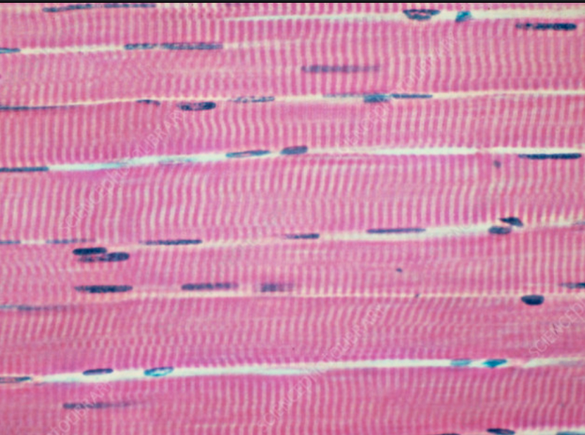 <p>Skeletal muscle.</p>