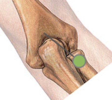 <p>Which bone landmark of the humerus is a big O-shaped depression on posterior side of elbow joint?</p>