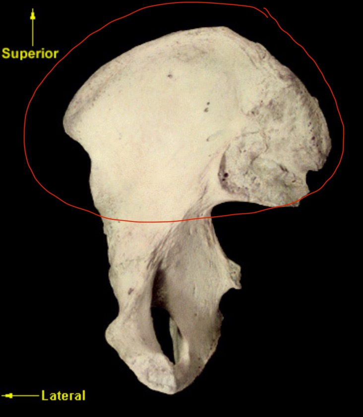<p>What bone is this?</p>