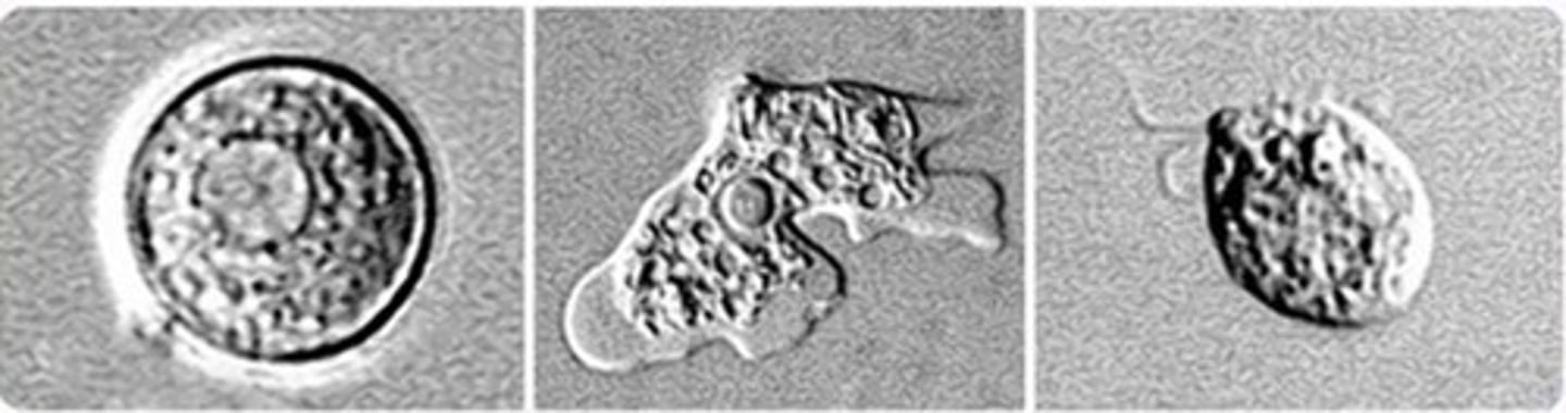 <p>Protozoa.</p><p>Causes Primary Amoebic Meningoencephalitis.</p><p>Enter through the nose and travels to the brain.</p><p>Commonly found in warm fresh water.</p><p>Only species that infects humans.</p><p>Almost always results in death.</p>