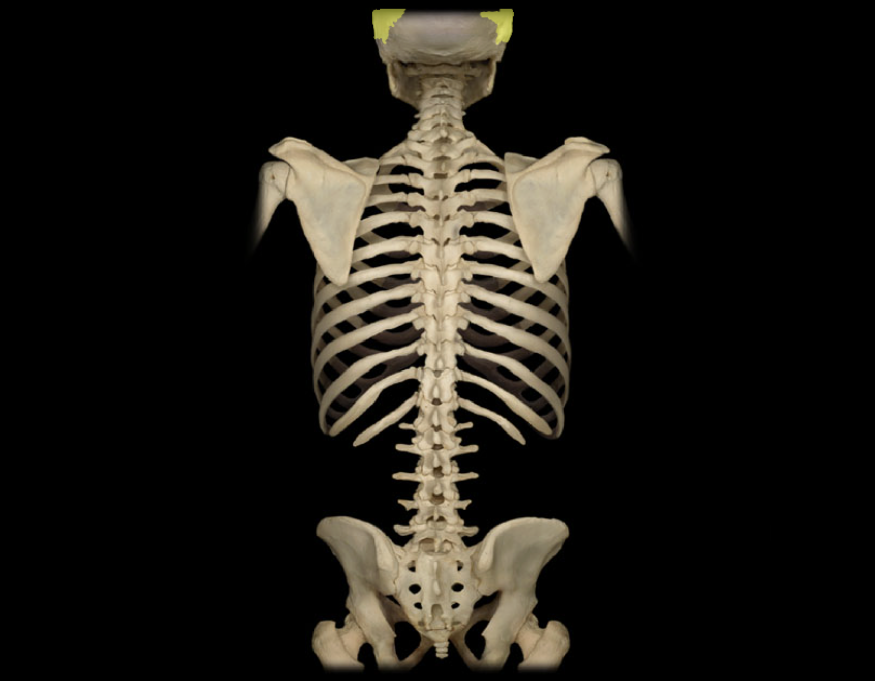 <p>Parietal bone</p>