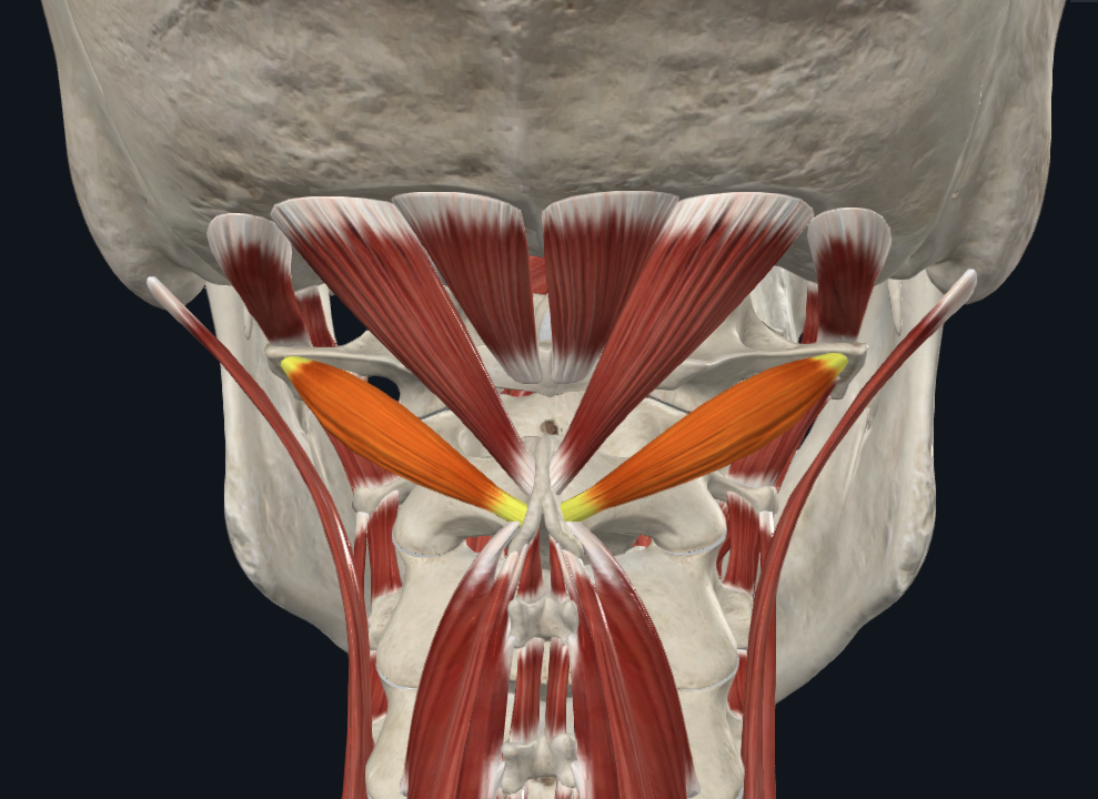 <p><strong>Nombre alterno: </strong>Oblicuo inferior</p><p><strong><mark data-color="yellow" style="background-color: yellow; color: inherit">Origen: </mark></strong><mark data-color="yellow" style="background-color: yellow; color: inherit">Apófisis espinosa del axis (C2)</mark></p><p><strong><mark data-color="blue" style="background-color: blue; color: inherit">Inserción: </mark></strong><mark data-color="blue" style="background-color: blue; color: inherit">Apófisis transversa del atlas (C1)</mark></p><p><strong><mark data-color="red" style="background-color: red; color: inherit">Acción: </mark></strong><mark data-color="red" style="background-color: red; color: inherit">Lateralización y rotación de la cabeza</mark></p><p><strong><mark data-color="purple" style="background-color: purple; color: inherit">Inervación: </mark></strong><mark data-color="purple" style="background-color: purple; color: inherit">Nervio suboccipital</mark><strong><br><mark data-color="green" style="background-color: green; color: inherit">Relaciones: </mark></strong><mark data-color="green" style="background-color: green; color: inherit">X</mark></p><p><strong>Notas:</strong></p>
