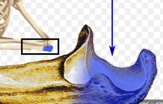 <p>name this bone or bone marking</p>