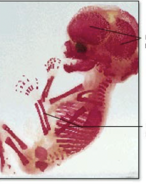 <p>arrow at head?</p>