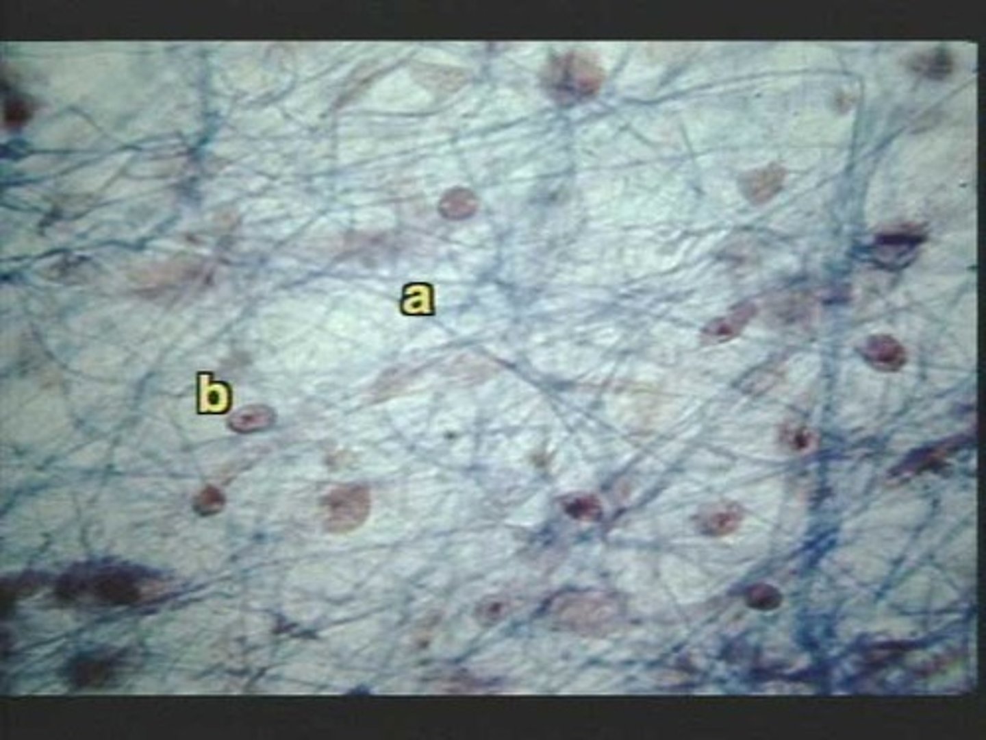 <p>dilusión de la sangre</p>