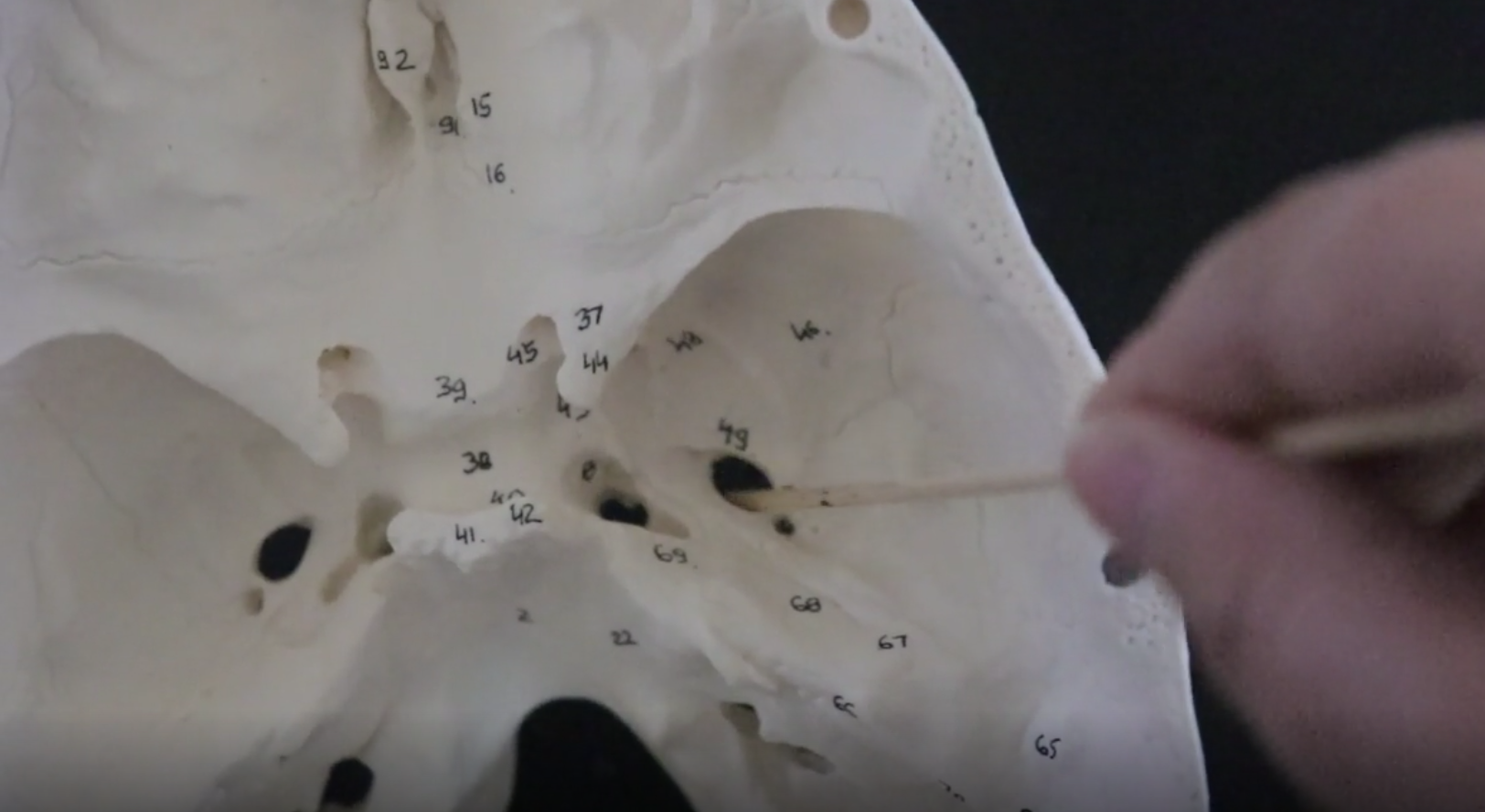 <p>hole in the sphenoid bone that allows nerves &amp; arteries pass through</p>