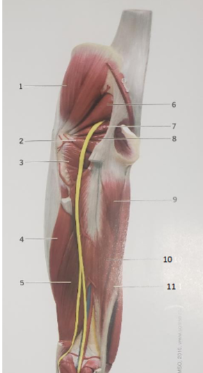 <p>Piriformis </p>