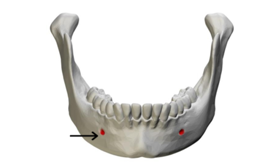 <p>What part of the mandible is this?</p>